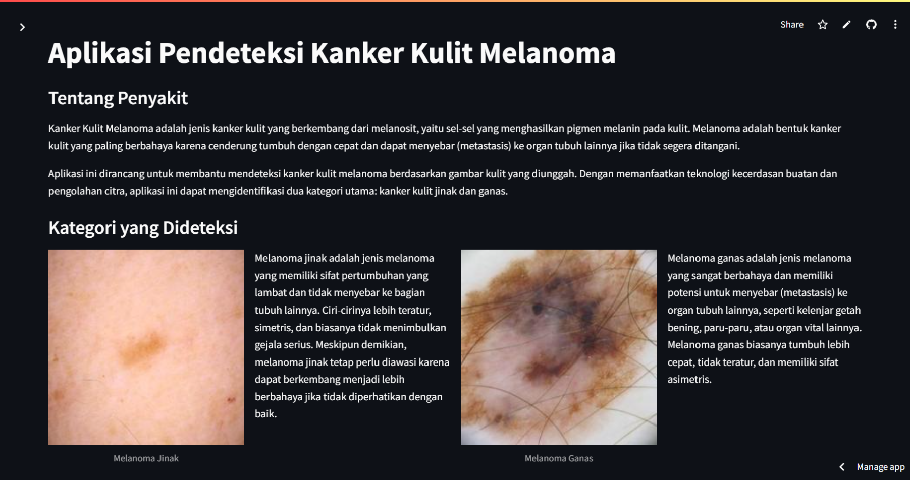 melanoma